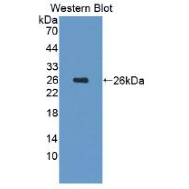 Apolipoprotein B100 (APOB100) Human Polyclonal Antibody