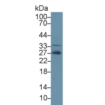 Adiponectin (ADPN) Chicken (Gallus) Polyclonal Antibody