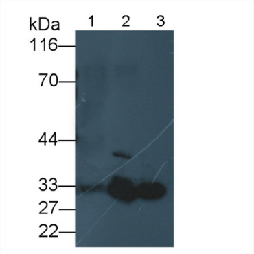 Adiponectin (ADPN) Human Polyclonal Antibody