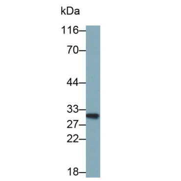 Adiponectin (ADPN) Mouse Polyclonal Antibody