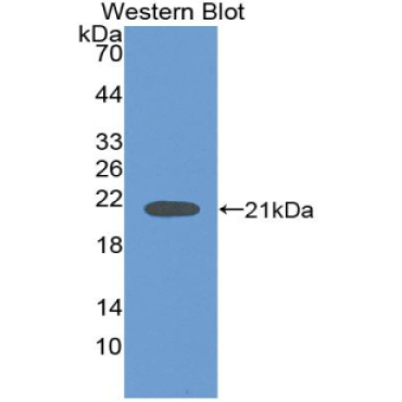 Neuroglobin (NGB) Mouse Polyclonal Antibody