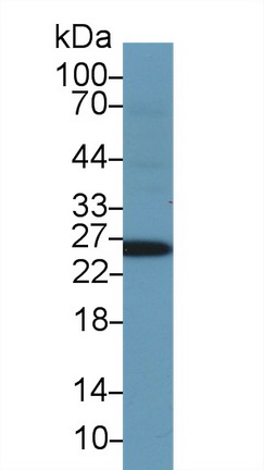 Glutathione S Transferase Alpha 1 (GSTa1) Human Polyclonal Antibody