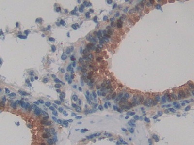 Glutathione S Transferase Alpha 1 (GSTa1) Rat Polyclonal Antibody