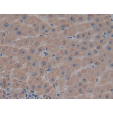 Thrombospondin 1 (THBS1) Human Polyclonal Antibody