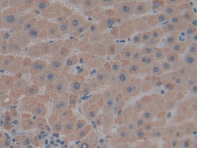 Thrombospondin 1 (THBS1) Human Polyclonal Antibody