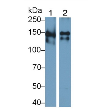 Thrombospondin 1 (THBS1) Human Polyclonal Antibody
