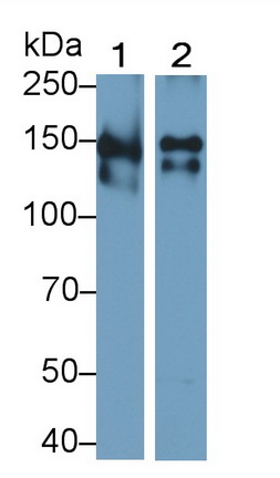 Thrombospondin 1 (THBS1) Human Polyclonal Antibody