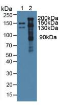 Thrombospondin 1 (THBS1) Mouse Polyclonal Antibody