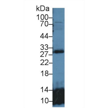 Glutathione S Transferase Theta 2 (GSTt2) Human Polyclonal Antibody