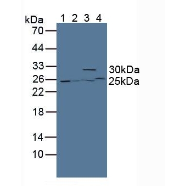 Glutathione S Transferase Theta 2 (GSTt2) Mouse Polyclonal Antibody
