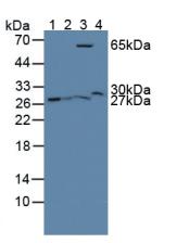 Glutathione S Transferase Theta 2 (GSTt2) Rat Polyclonal Antibody