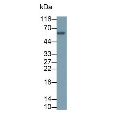 Carboxypeptidase B2 (CPB2) Mouse Polyclonal Antibody