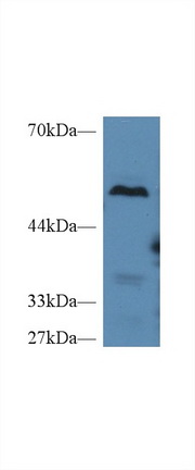Carboxypeptidase B2 (CPB2) Mouse Polyclonal Antibody