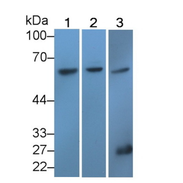 Transcription Factor P65 (NFKB3) Human Polyclonal Antibody