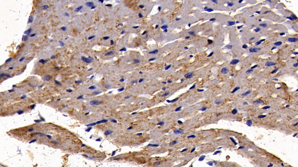 Transcription Factor P65 (NFKB3) Mouse Polyclonal Antibody