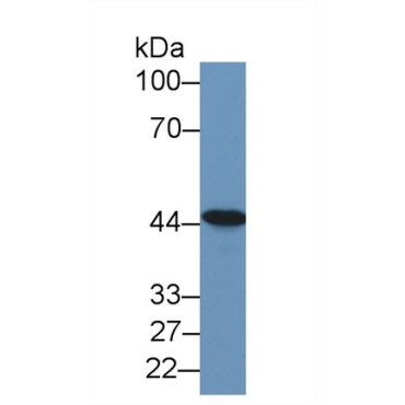 Tachykinin Receptor 2 (TACR2) Human Polyclonal Antibody