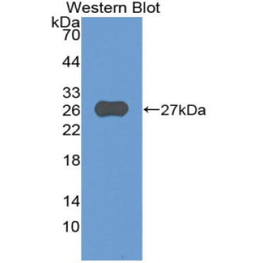 A Disintegrin And Metalloprotease 8 (ADAM8) Human Polyclonal Antibody