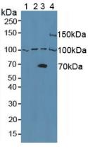 A Disintegrin And Metalloprotease 8 (ADAM8) Mouse Polyclonal Antibody