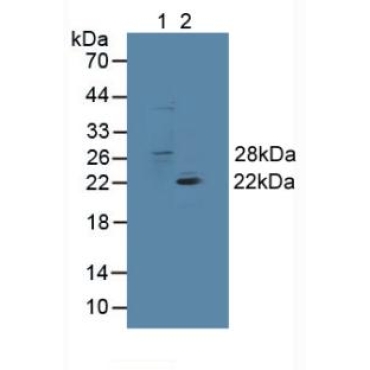 Glutathione S Transferase Theta 1 (GSTt1) Mouse Polyclonal Antibody