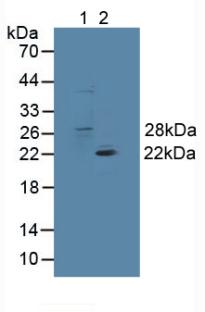 Glutathione S Transferase Theta 1 (GSTt1) Mouse Polyclonal Antibody