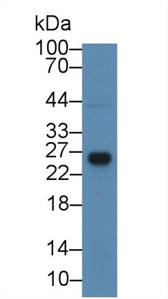 Glutathione S Transferase Theta 1 (GSTt1) Rat Polyclonal Antibody