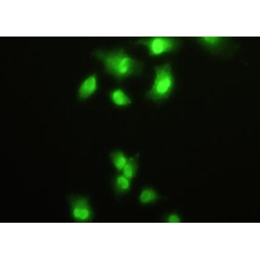 Hepatoma Derived Growth Factor (HDGF) Human Polyclonal Antibody