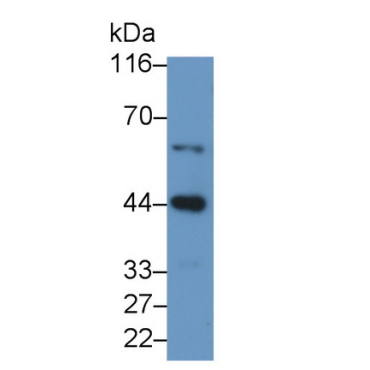 Caspase 9 (CASP9) Human Polyclonal Antibody