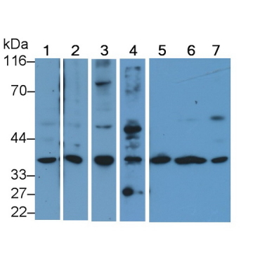 Caspase 9 (CASP9) Human Polyclonal Antibody