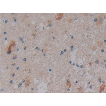 Nitric Oxide Synthase Trafficker (NOSTRIN) Human Polyclonal Antibody