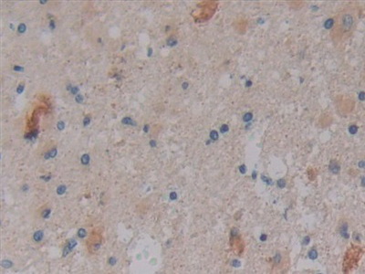 Nitric Oxide Synthase Trafficker (NOSTRIN) Human Polyclonal Antibody