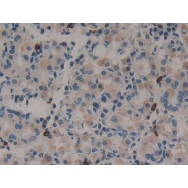 Midkine (MK) Human Polyclonal Antibody