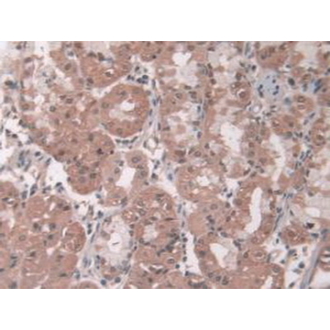 Pepsin (PP) Human Polyclonal Antibody