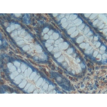Platelet Derived Growth Factor BB (PDGF BB) Human Polyclonal Antibody