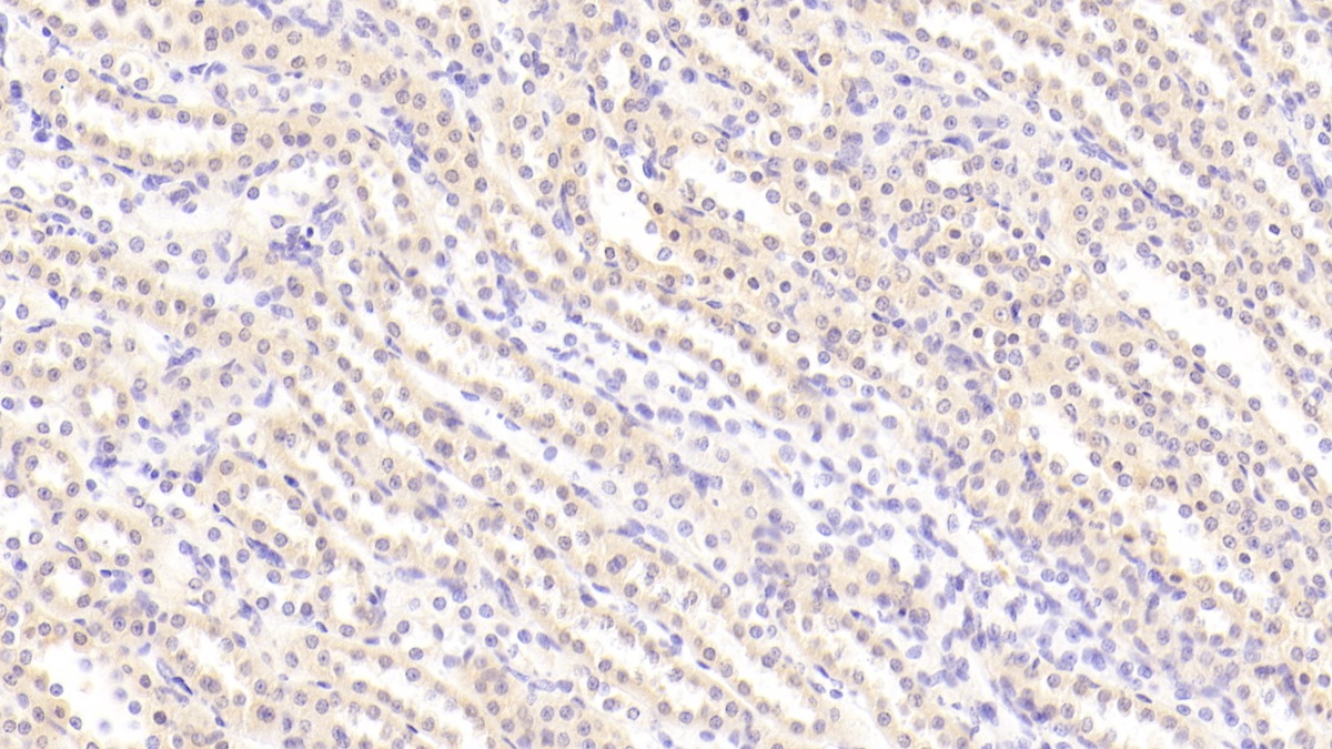 Platelet Derived Growth Factor BB (PDGF BB) Rat Polyclonal Antibody