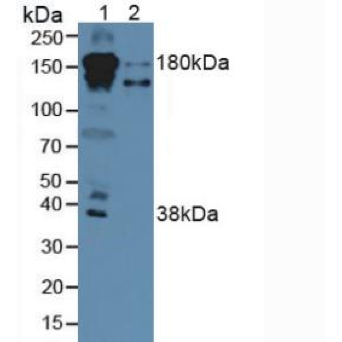 Complement Factor H (CFH) Human Polyclonal Antibody