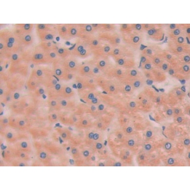 Hexosaminidase B Beta (HEXb) Human Polyclonal Antibody