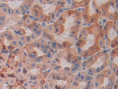 Hexosaminidase B Beta (HEXb) Mouse Polyclonal Antibody