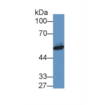 Visfatin (VF) Human Polyclonal Antibody