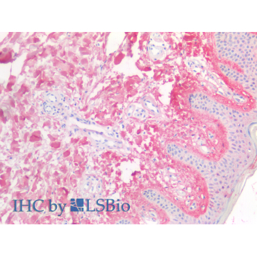 Cross Linked N-Telopeptide Of Type I Collagen (NTXI) Human Polyclonal Antibody