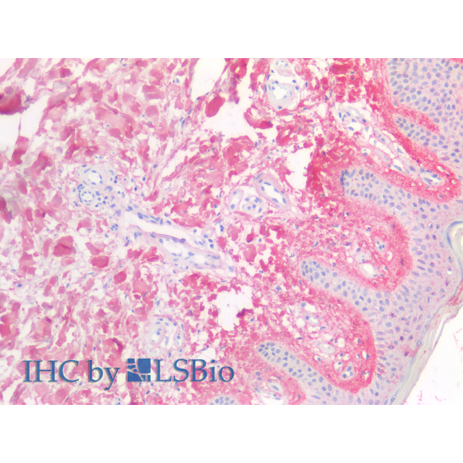 Cross Linked N-Telopeptide Of Type I Collagen (NTXI) Human Polyclonal Antibody