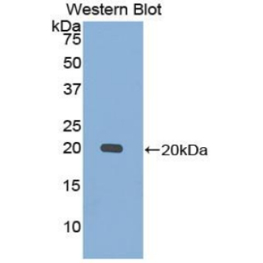 Calmodulin (CAM) Human Polyclonal Antibody