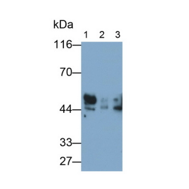 Receptor For Advanced Glycation Endproducts (RAGE) Human Polyclonal Antibody