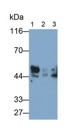 Receptor For Advanced Glycation Endproducts (RAGE) Human Polyclonal Antibody