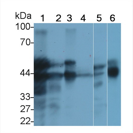 Receptor For Advanced Glycation Endproducts (RAGE) Mouse Polyclonal Antibody