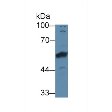 Bone Morphogenetic Protein 6 (BMP6) Human Polyclonal Antibody