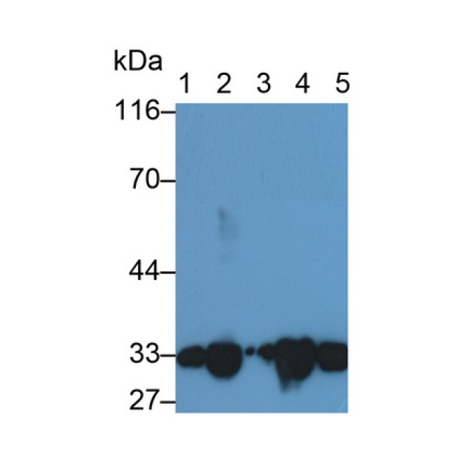 Complement component 1 Q subcomponent-binding protein, mitochondrial (C1QBP) Human Polyclonal Antibody