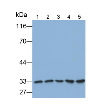 Complement component 1 Q subcomponent-binding protein, mitochondrial (C1QBP) Human Polyclonal Antibody