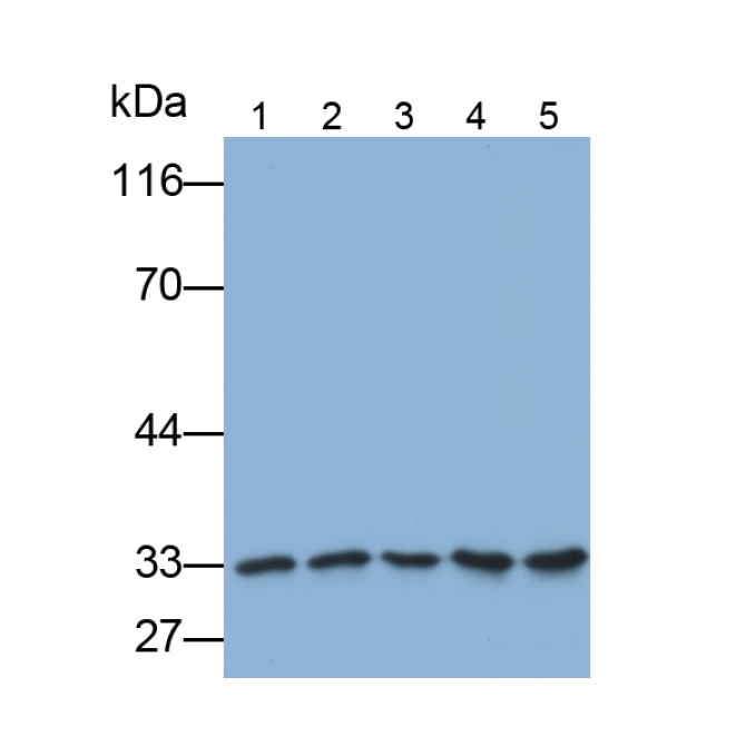 Complement component 1 Q subcomponent-binding protein, mitochondrial (C1QBP) Human Polyclonal Antibody