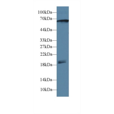 Calcium/Calmodulin Dependent Protein Kinase II Gamma (CAMK2g) Human Polyclonal Antibody