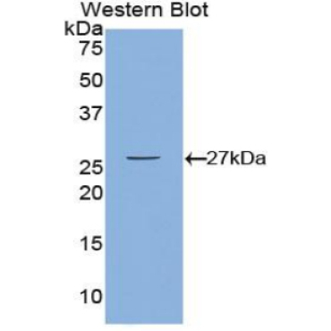 Calcium/Calmodulin Dependent Protein Kinase II Gamma (CAMK2g) Mouse Polyclonal Antibody